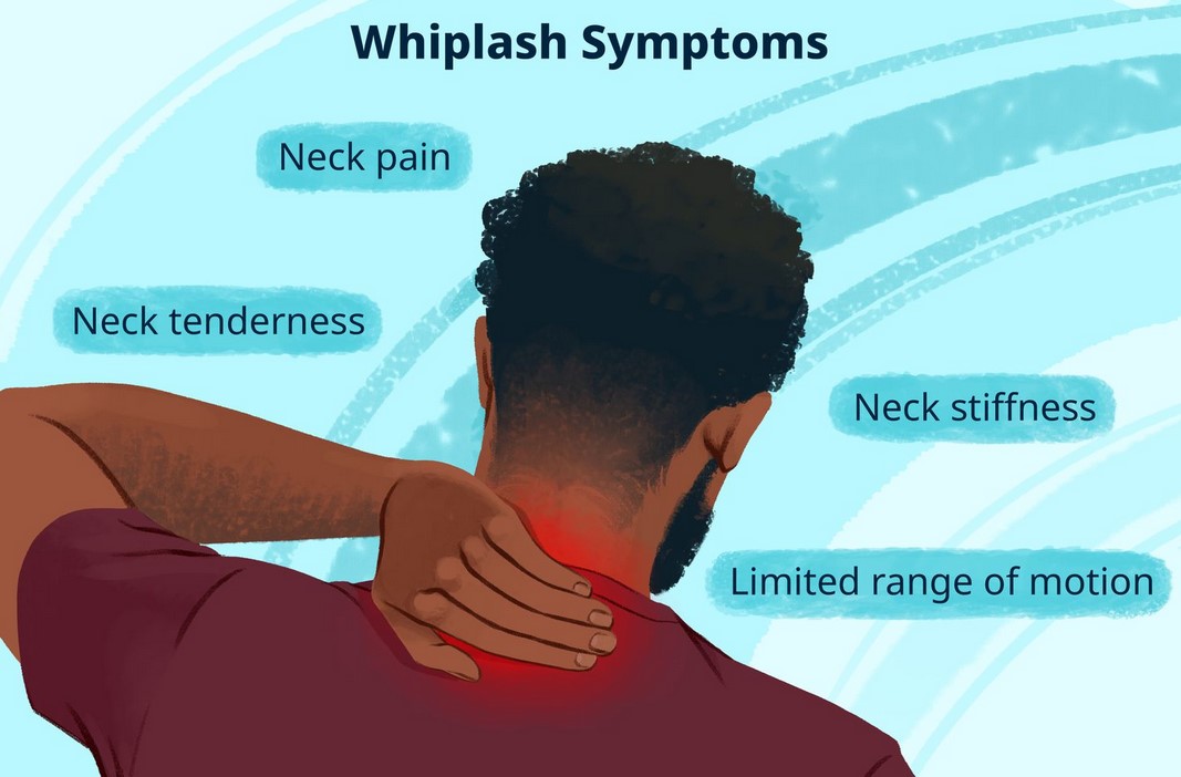 Whiplash Symptoms